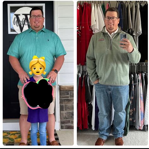 6 months HRT vs 18 months and 7 sessions of laser. Same hat and coat ...