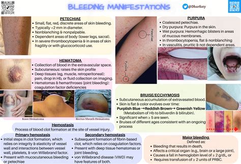 Ecchymosis Vs Bruise
