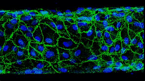 Researchers go to the source to find new tools to treat vascular diseases | Texas A&M University ... - treat venous disease