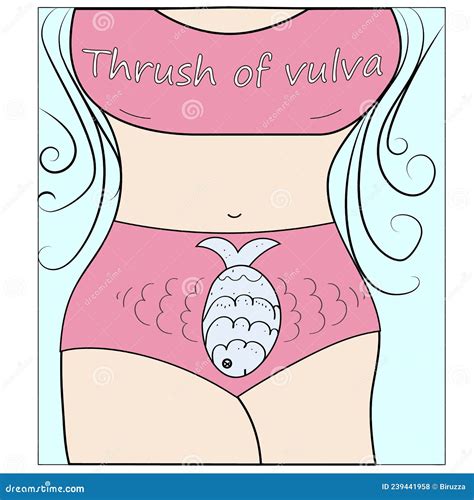 Vaginal Thrush, Candidiasis. Vaginal Infection Stock Vector ...