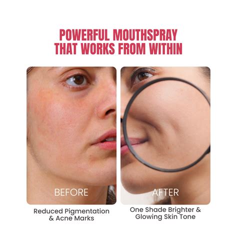 Nutrispray Gluta | Glutathione Supplement Spray