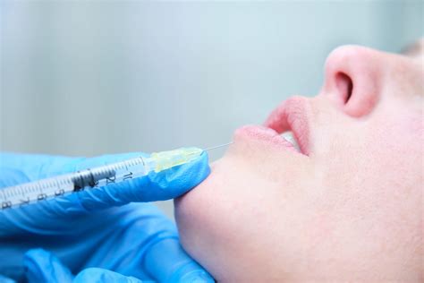 How Much Does It Cost to Dissolve Lip Fillers?