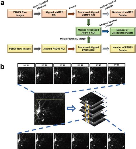 Image result for Image Processing Using ImageJ