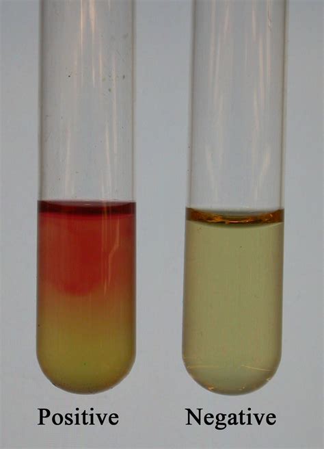 Voges Proskauer Test