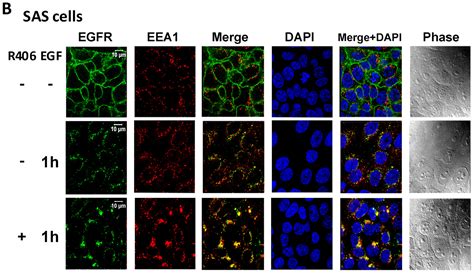Synergistic Anti-Tumour Effect of Syk Inhibitor and Olaparib in ...