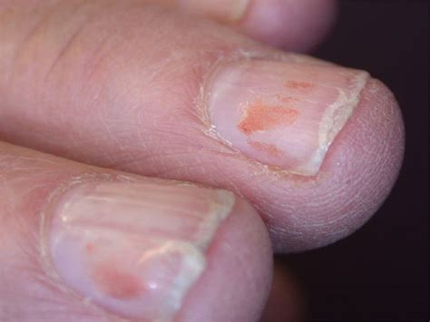 How to Fix Split Nails 的图像结果