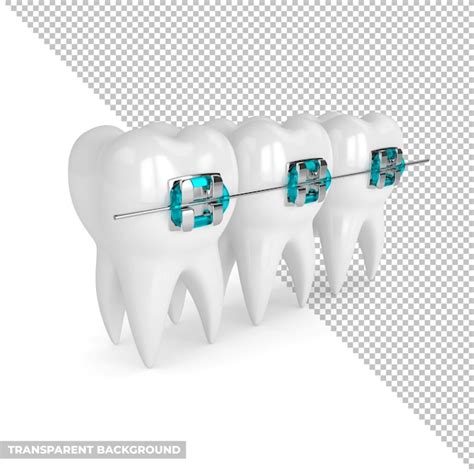 Teeth with Orthodontic Braces A 3D Cartoon Illustration | PSD Premium