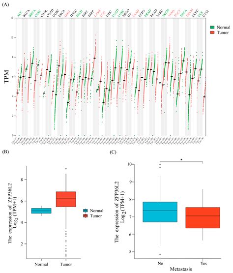 ZFP36L2 Is a Potential Prognostic Marker of IL1β+ Osteosarcoma