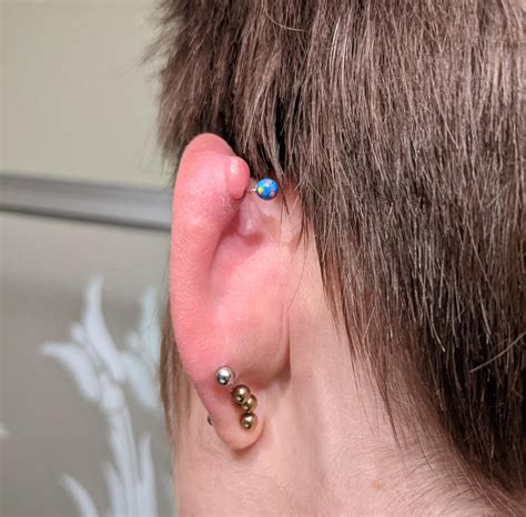 Irritation bump : r/piercing
