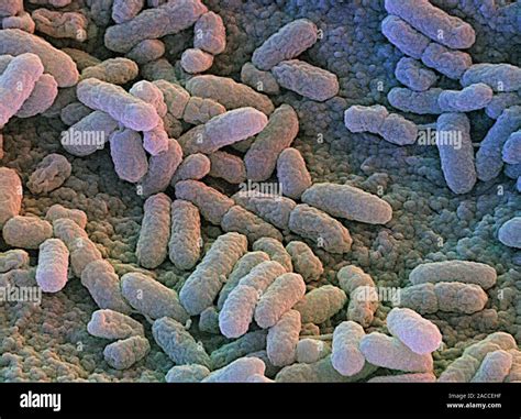 Salmonella enteritidis bacteria. Coloured scanning electron micrograph ...