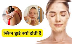 किस विटामिन की कमी से ड्राई होने लगती है स्किन? | Which Vitamin The ...