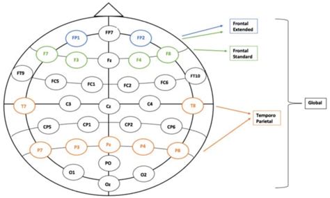 Quantitative EEG as a Biomarker in Evaluating Post-Stroke Depression