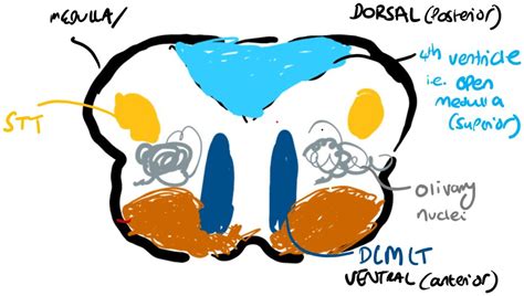 Image result for Brain Exploding Vector