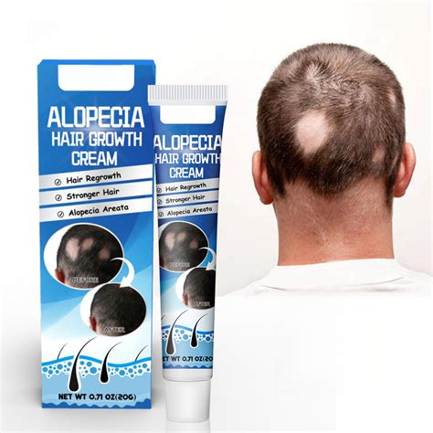Honpoloalopecia Hair Growth Cream 20g Revitalizing Scalp And Promoting ...