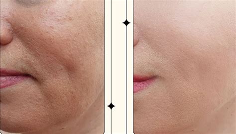 The Ayurvedic Cream That Shocked Dermatologists – Shata Dhauta Ghrita ...