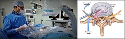 PAIN CARE CLINIC