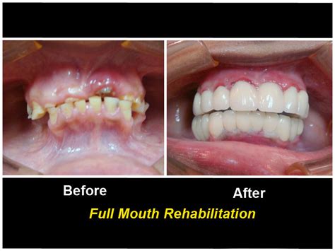 Deep Dental Care - Ahmedabad | Dentist In Ahmedabad, Dental Clinic In ...