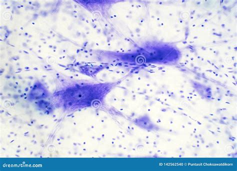 Neurons Cells from the Brain Under the Microscope View Stock Photo ...
