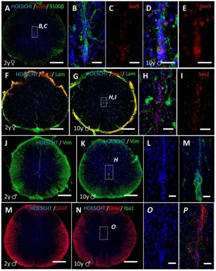 The Structure of the Spinal Cord Ependymal Region in Adult Humans Is a ...