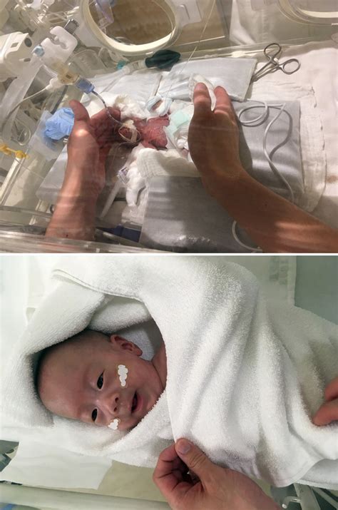 出生时仅268克 “世界最小的男婴”平安出院(图) - 2019年2月26日 / 头条新闻 - 看帖神器