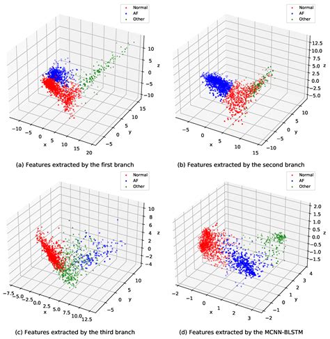An Effective Atrial Fibrillation Detection from Short Single-Lead ...