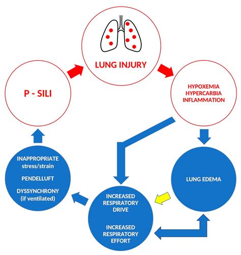 Patient Self-Inflicted Lung Injury—A Narrative Review of ...