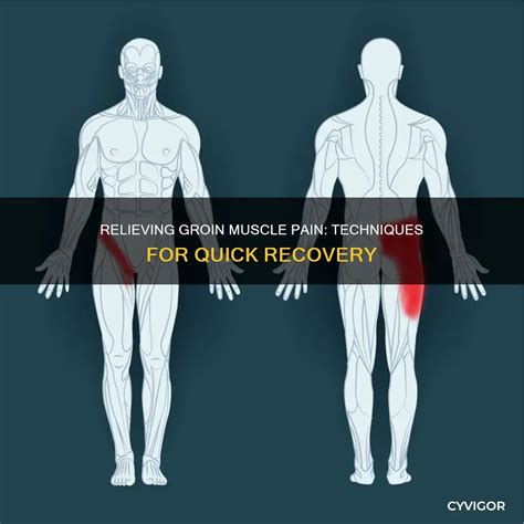 Relieving Groin Muscle Pain: Techniques For Quick Recovery | CyVigor