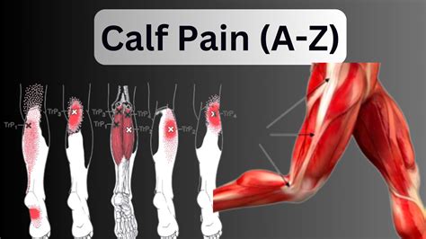 Don't Ignore Calf Pain View: Causes, Symptoms & Best Treatment