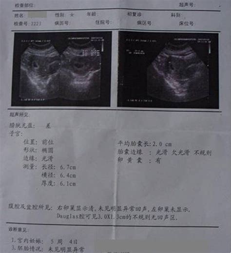 40天孕囊大小看男女对照表，这三个尺寸数据预测男孩超准_家庭医生在线