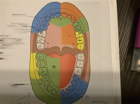 Local Anesthesia Classification 的图像结果