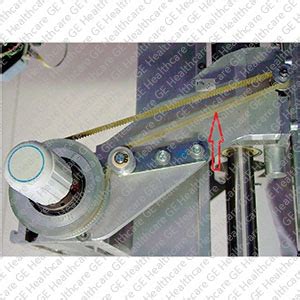 Belt Manual Compression Synchonous 600mm, Mammography | GE HealthCare ...