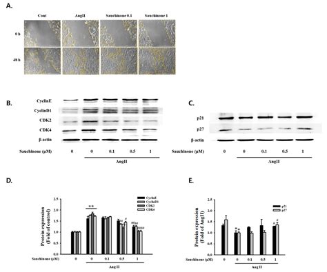 Sauchinone Protects Renal Mesangial Cell Dysfunction against ...