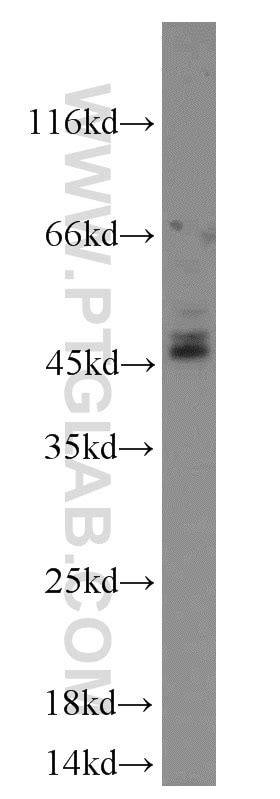 CD37 antibody (21044-1-AP) | Proteintech