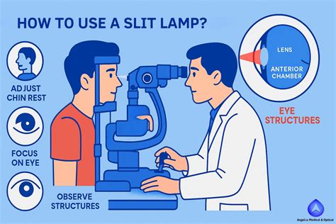 Slit Lamp Exam Guide: How to Use It Properly?