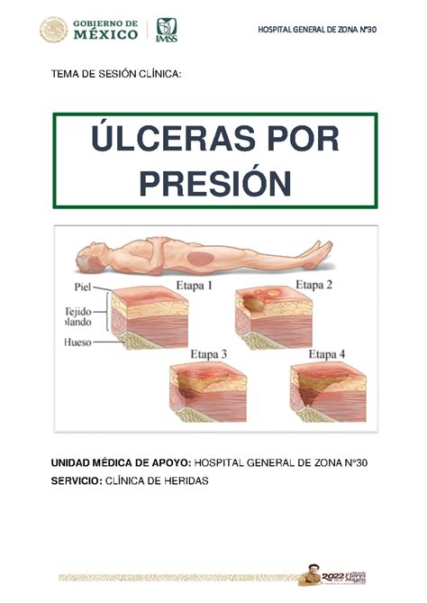Sesión Clínica: Úlceras por Presión - TEMA DE SESIÓN CLÍNICA: UNIDAD ...
