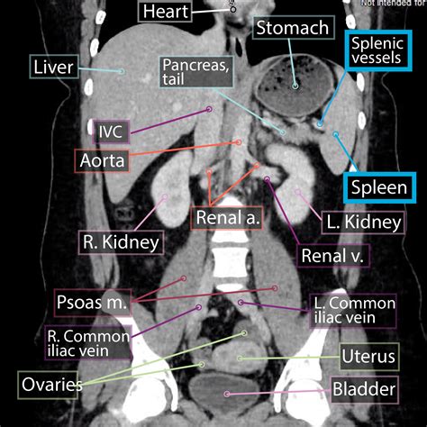 Advanced Anatomy & Physiology: Spleen | ditki medical & biological sciences