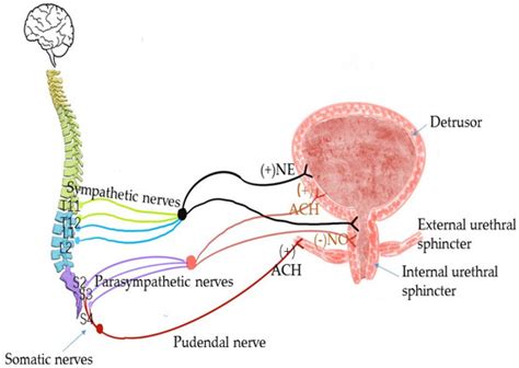 The Anatomical Pathogenesis of Stress Urinary Incontinence in Women