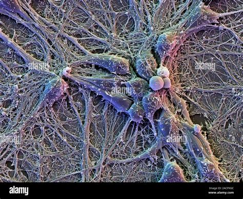 Neuron Electron Microscope