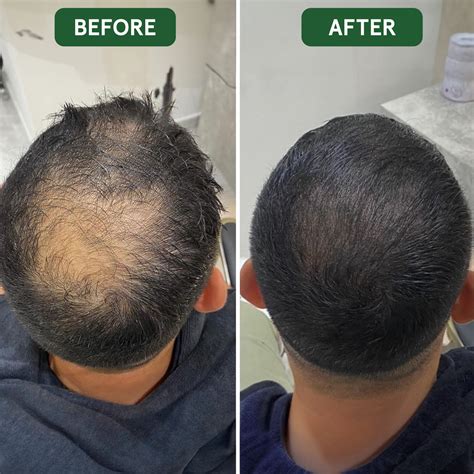 100% Organic Batana Hair Growth Oil - Divine Vitals