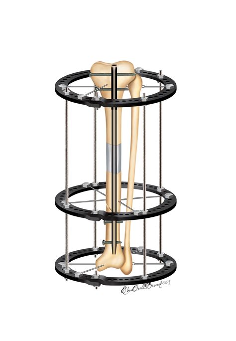 Image result for Spahetti HTML Code