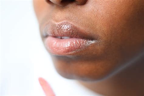 Chapped Lips? Why, oh why?! | LoveChild Masaba