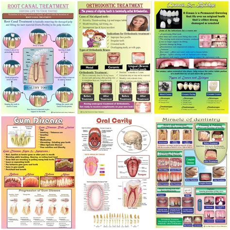 Buy Unique Dents Dental Education Posters (DWP01) - Set Of 6 – Oralkart