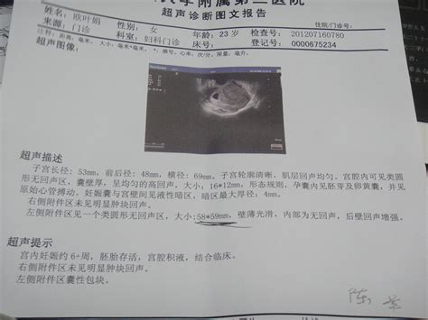 怀孕21周胎儿彩超图，这正常吗？_百度宝宝知道-请医生帮我看看做的胎儿彩超图.是否正常