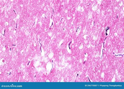 Human Nervous System Under the Microscope in Lab. Stock Image - Image ...