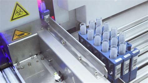 How Is PCR Test Done 的图像结果