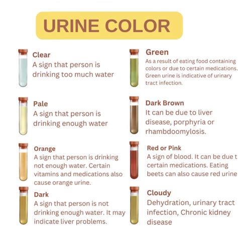Urinary Tract Infection Urine Color Free Printable Urine Color Charts