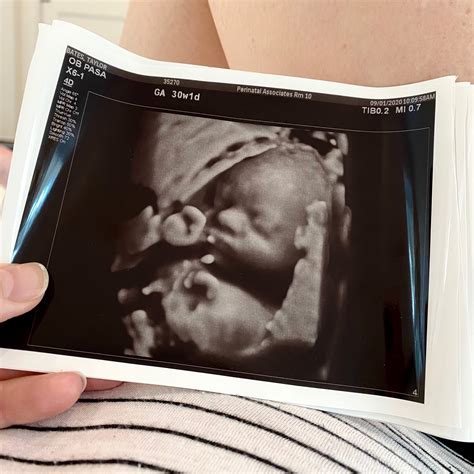 30 Weeks Pregnant Fetus