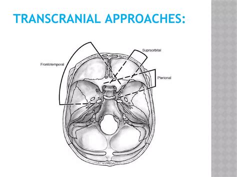 Anterior cranial-fossa | PPT