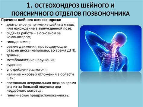 Шейный остеохондроз - презентация онлайн
