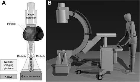 Technical Advances in Image Guidance of Radionuclide Therapy | Journal ...